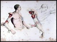 Illustrations of the Great Operations of Surgery, Trepan, Hernia, Amputation, Aneurism, and Lithomy