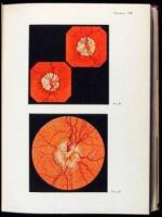 Fundus Oculi: Ophthalmoskopische Diagnose