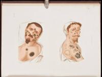 Atlas of Venereal Diseases