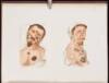 Atlas of Venereal Diseases