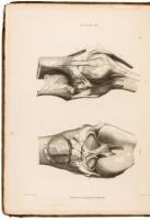 A Treatise on Ligaments