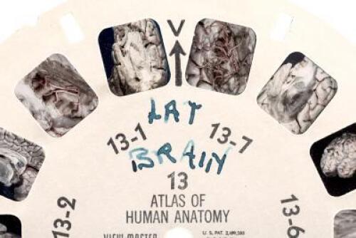 A Stereoscopic Atlas of Human Anatomy