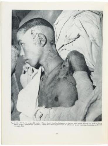 The Effects of Atomic Bombs on Health and Medical Services in Hiroshima and Nagasaki