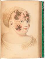 Delineations of Cutaneous Diseases: Exhibiting the characteristic appearances of the principal genera and species comprised in the classification of the late Dr. Willan; and completing the series of engravings begun by that author
