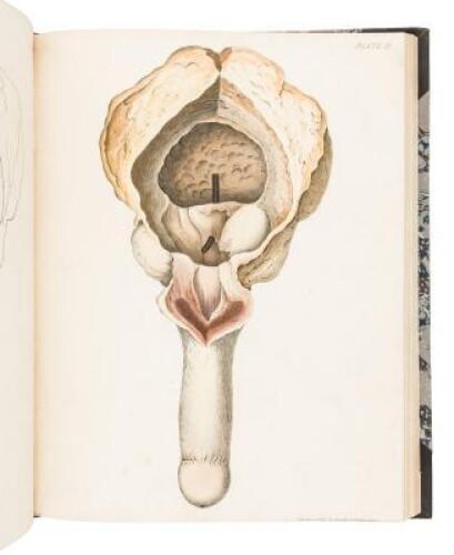 A Treatise on the Formation, Constituents, and Extraction of the Urinary Calculus; Being the Essay for which the Jacksonian Prize for the Year 1833 was awarded by the Royal College of Surgeons in London