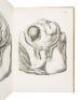 A Set of Anatomical Tables with Explanations and an Abridgement of the Practice of Midwifery: with a View to Illustrate a Treatise on that Subject, and Collection of Cases - 2