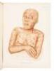 Atlas of the Diseases of the Skin in a Series of Illustrations from Original Drawings with Descriptive Letterpress - 5