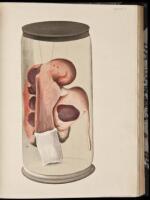 A Treatise on the Formation, Constituents, and Extraction of the Urinary Calculus; Being the Essay for Which the Jacksonian Prize for the Year of 1833 was Awarded by the Royal College of Surgeons in London