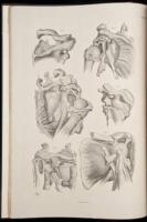 On Dislocations and Fractures
