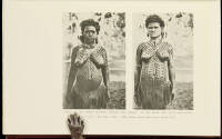 The History of Tattooing and Its Significance With Some Account of Other Forms of Corporal Marking