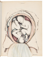 Obstetric Tables: Comprising Graphic Illustrations, with Descriptions and Practical Remarks; Exhibiting on Dissected Plates many Important subjects in Midwifery