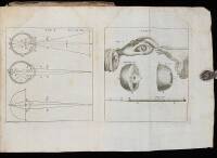 Trattato della Cataratta, Del Glaucoma, E Dell'Amaurosi