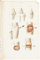 Pr&eacute;cis Iconographique de M&eacute;dicine Op&eacute;ratoire et d'Anatomie Chirurgicale
