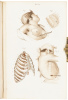 Pr&eacute;cis Iconographique de M&eacute;dicine Op&eacute;ratoire et d'Anatomie Chirurgicale - 5