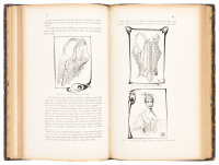 Le Corset histoire - Medicine - Hygiéne : &Eacute;tude Médicale