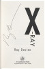 X-Ray - 2