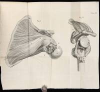 A Case of an Extra-Uterine Foetus. [In: Medical Observations and Inquiries, Vol. II]
