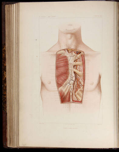 Atlas Complet d'Anatomie Chirurgicale Topographique