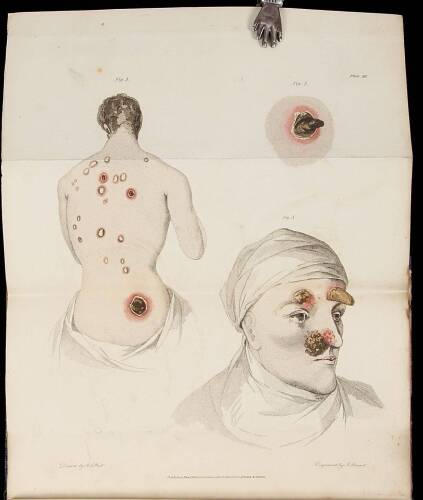 An Essay on Venereal Diseases, and the uses and abuses of mercury in their treatment
