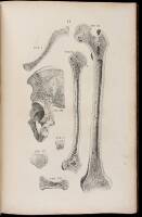 Osteographia; or, The Anatomy of the Bones