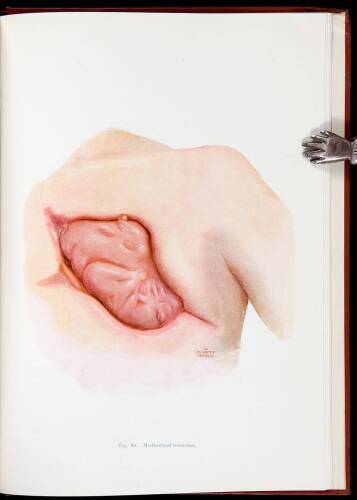 Surgery of the Lung and Pleura