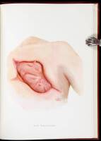 Surgery of the Lung and Pleura