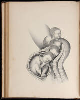 An Illustrated Encyclopaedia of the Science and Practice of Obstetrics