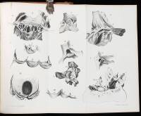 A Treatise on the Diseases of the Heart and Great Vessels and on the Affections Which May be Mistaken for Them