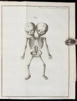 Bound volume of 15 teratology offprints from the Memoirs of the Royal Academy of Sciences