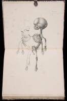 Recherches d'Anatomie Transcendante et Pathologique. Theorie des formations et des d&eacute;formations organiques, appliqu&eacute;e &agrave; l'anatomie de Ritta Christina, et de la duplicit&eacute; monstrueuse.