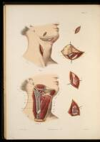 A Course of Operative Surgery, With Plates Drawn from Nature by M. L&eacute;veill&eacute;