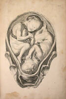 A Sett of Anatomical Tables with Explanations, and an Abridgement, on the Practice of Midwifery...